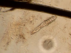 Imagen de microscopio Citología cutánea. ACARO DEMODEX. Sarna demodécica del perro
